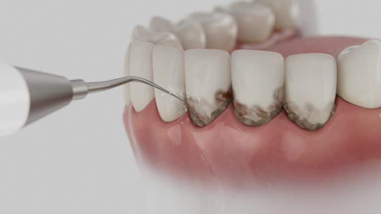 Reliable Dental Implants contractor in Chicago Ridge, IL by Smile Center Dentistry